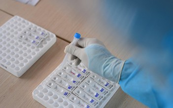 Khuyến cáo xét nghiệm PCR để tránh bỏ sót ca bệnh Covid-19