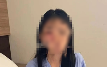 Nữ sinh lớp 8 ở Hà Nội bị đánh hội đồng bầm dập