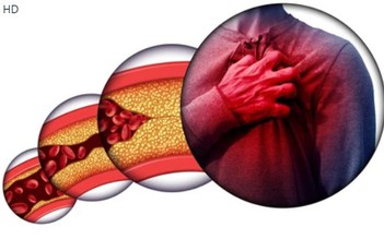 Đồ uống tuyệt vời giảm cholesterol, nhiều người dùng hằng ngày mà không biết