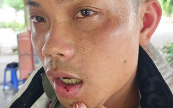 Chủ quán hải sản ở Nha Trang: Nhân viên đánh người là sai nhưng quyết làm rõ mọi chuyện