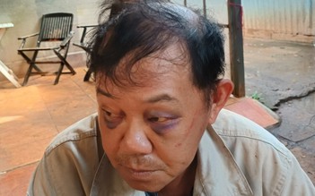 Lâm Đồng: Ngang nhiên xông vào nhà đánh, chém 7 người bị thương
