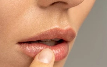 Đâu là nguyên nhân thực sự gây ngứa môi?