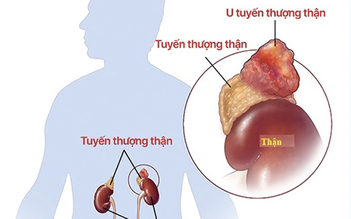 Trẻ bị cao huyết áp do bệnh hiếm