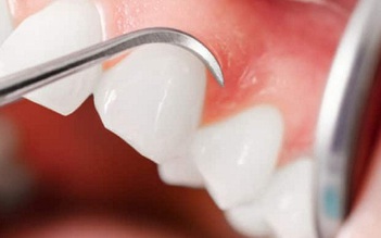 Ngày mới với tin tức sức khỏe: Thuốc mới giúp người trưởng thành có thể mọc lại răng