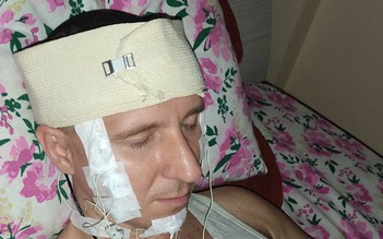 Người đàn ông Nga tự khoan hộp sọ để cấy thiết bị 'điều khiển giấc mơ'