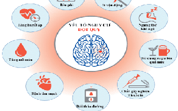 Điều trị dự phòng giúp giảm 80% nguy cơ tái phát đột quỵ