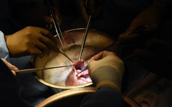 Bệnh nhân thứ 2 trên thế giới được cấy ghép tim lợn