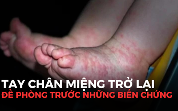 Bệnh tay chân miệng trở lại ở trẻ: Cần theo dõi để tránh biến chứng nặng