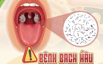 Bệnh bạch hầu: Đặc biệt chú ý khi giả mạc lan rộng