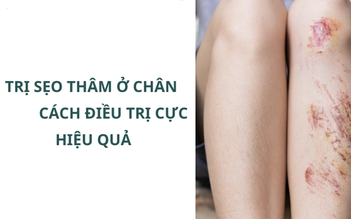 Kem trị sẹo thâm ở chân nào hiệu quả ngay tại nhà mà không cần xâm lấn?