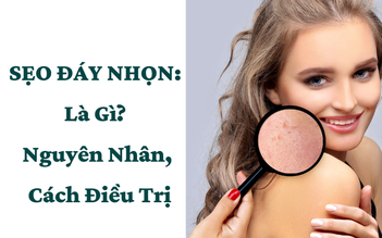 Sẹo đáy nhọn là gì? Top 5 cách điều trị sẹo đáy nhọn hiệu quả hiện nay