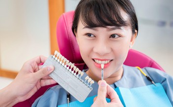 Cẩn trọng khi lựa chọn dán răng sứ không mài: Những điều cần biết