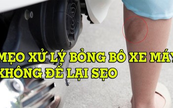 Bỏng bô xe máy nên làm gì để vết thương mau lành và hạn chế sẹo xấu?