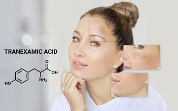 Tranexamic Acid là gì? Tác dụng với làn da và top 3 sản phẩm hiệu quả