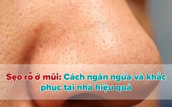 Cách trị sẹo rỗ ở mũi hiệu quả ngay tại nhà da sáng mịn thêm tự tin