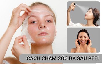 Liệu trình chăm sóc da sau peel đúng chuẩn y khoa da khỏe đẹp rạng rỡ