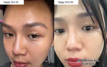 97% phụ nữ bổ sung collagen đúng cách da căng sáng trẻ hơn chục tuổi là thật!