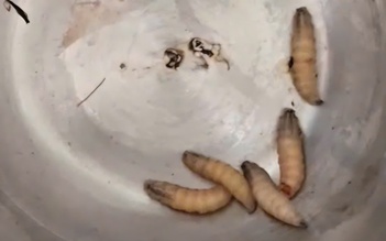 Gắp 5 con giòi sống trong tai bệnh nhân