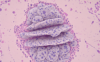 Các nhà khoa học tạo ra 'vũ khí tàng hình' tiêu diệt ung thư