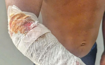 Đang câu cá, bị cá sấu tấn công