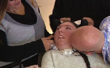 Phép màu cô gái không có não vẫn sống đến 20 tuổi