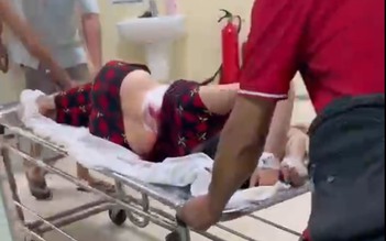 Điều tra vụ người phụ nữ bị con riêng của ba chồng dùng dao tấn công