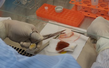 Tế bào gốc có thể lưu trữ đến 50 năm