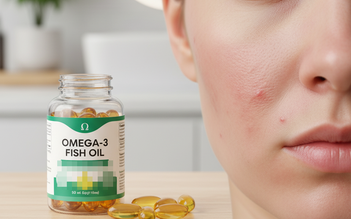 Những dấu hiệu thiếu omega-3 có thể bạn chưa biết