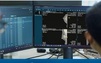 Việt Nam có sản phẩm AI chẩn đoán X-quang tuyến vú được FDA công nhận