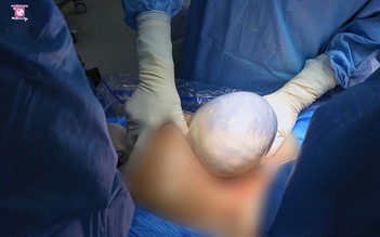 Cặp song sinh chào đời trong bọc điều tại Bệnh viện Phương Nam