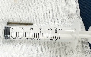 Bé trai 6 tuổi ở Quảng Ngãi thoát nguy hiểm nhờ được  gắp đinh sắt trong bụng