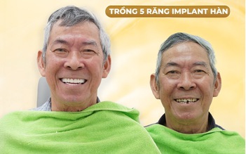 Trồng implant tại Nha khoa Parkview - Giải pháp hiệu quả cho người mất răng
