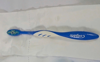 Cứu cô gái nuốt bàn chải dài 17 cm vào thực quản