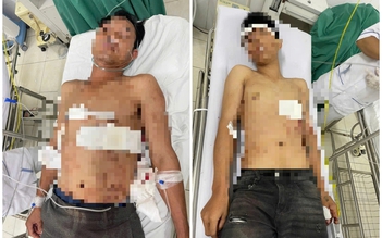 Khánh Hòa: Điều tra vụ 3 người bị đâm trọng thương