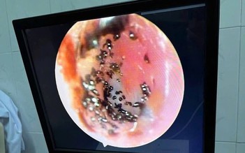 Ve chó ký sinh, làm tổ và sinh sản trong ống tai bé trai