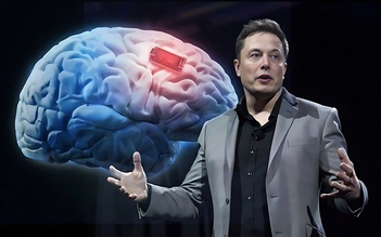 Tự chỉnh video, kể chuyện bằng... chip não Neuralink