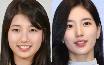 Sự thay đổi ngoại hình của Suzy gây tò mò