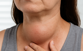 Bước tiến mới trong phẫu thuật tuyến giáp không để lại sẹo