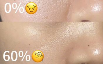 Top 5 Retinol thay mới làn da ‘căng bóng trẻ hóa’ xứng đáng dùng tới già