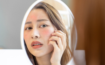 Top 7 sản phẩm làm dịu da đỏ, kích ứng sau laser hiệu quả