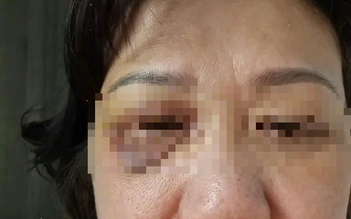 TP.HCM: 2 vợ chồng trẻ hành hung người phụ nữ 60 tuổi tại sảnh chung cư