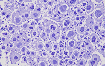 Nghiên cứu: Tìm ra cách điều trị hiệu quả ung thư gan, phổi và dạ dày