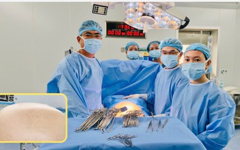 Khối u buồng trứng hơn 20 kg nhưng tưởng tăng cân