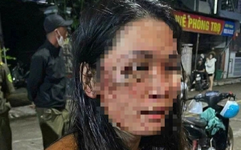 Công an xác minh vụ nữ shipper ở Đắk Lắk bị hành hung, phải nhập viện