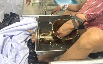 TP.HCM: Bị máy xay thịt 'nuốt chửng' tay, phải đưa cả người và máy vào phòng mổ