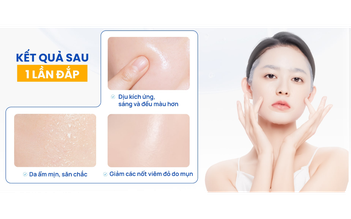 Thương hiệu Việt lên ngôi: Top 3 mặt nạ da căng mướt, bừng sáng sau 1 đêm
