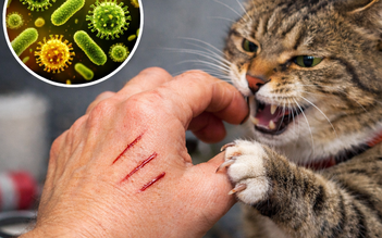 TP.HCM: Người đàn ông tử vong sau mèo cào, bác sĩ cảnh báo nguy hiểm bệnh dại