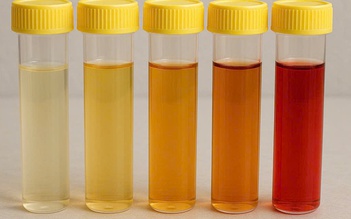 Màu nước tiểu cảnh báo thận đang gặp vấn đề