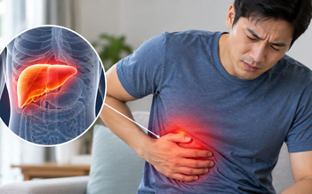 3 dấu hiệu cảnh báo gan nhiễm mỡ đang tiến triển