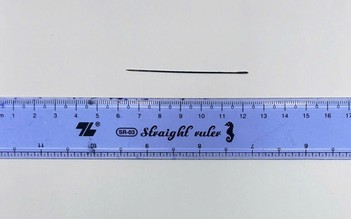 Kim may đồ nằm trong gan người đàn ông 41 tuổi